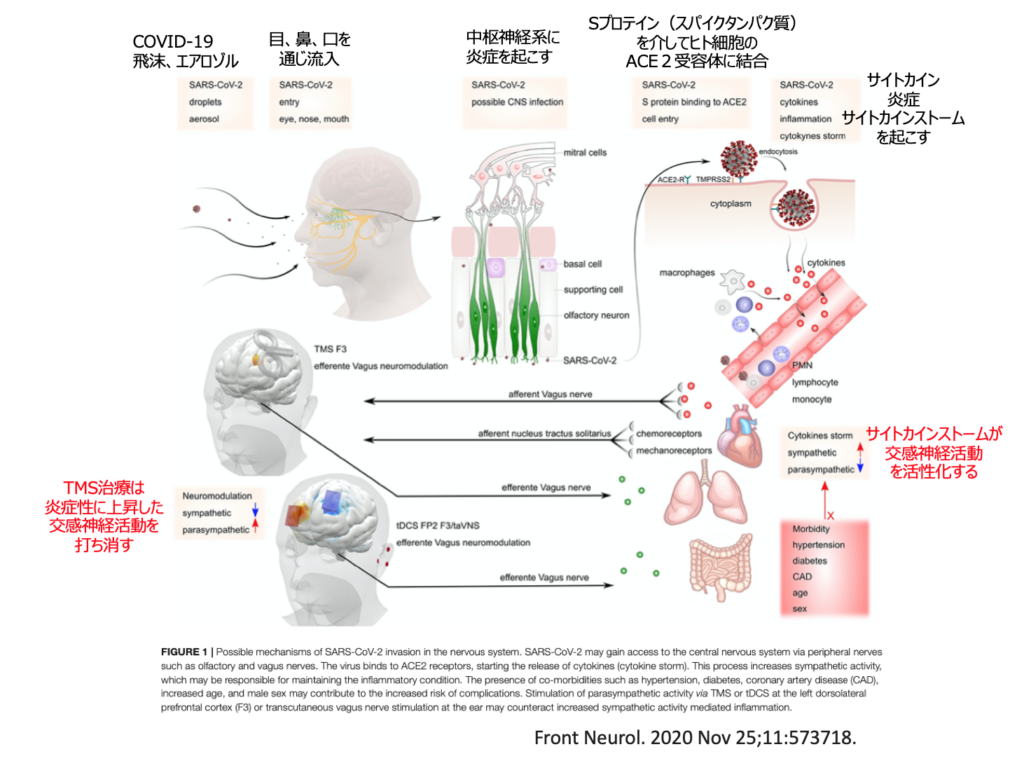専用】 tDCS 香ばしく 磁気刺激治療 抑うつ状態を改善